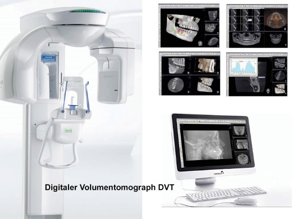digitaler volumen tomograph